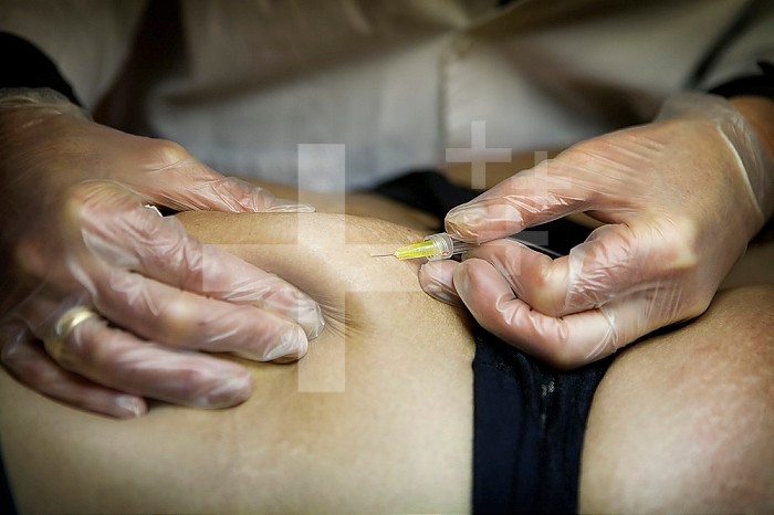 Treatment of cellulite and stretch marks by carboxytherapy, or the subcutaneous injection of carbon dioxide.