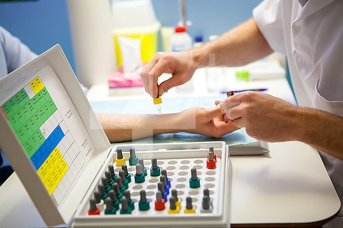Allergological skin tests carried out by an allergist, allergen kit.