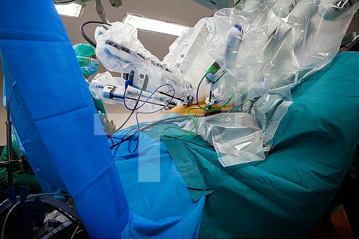 Hysterectomy in an operating room of a hospital with a robot surgeon.