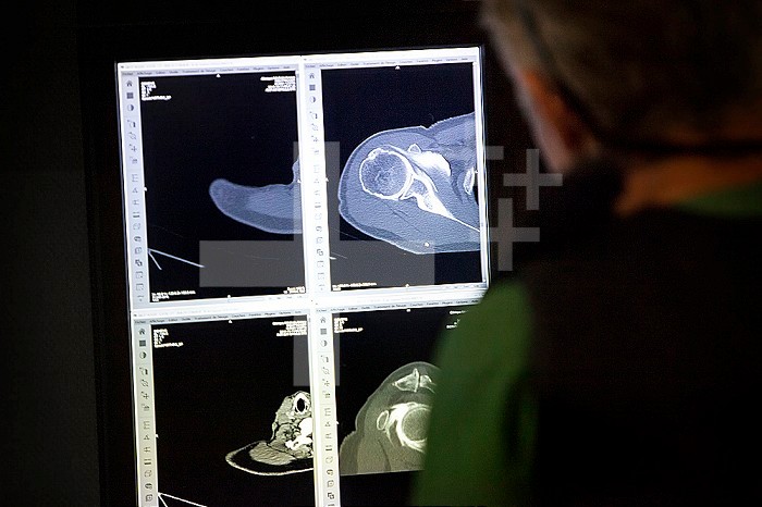In a radiology center, a radiologist observes scans of the shoulder.