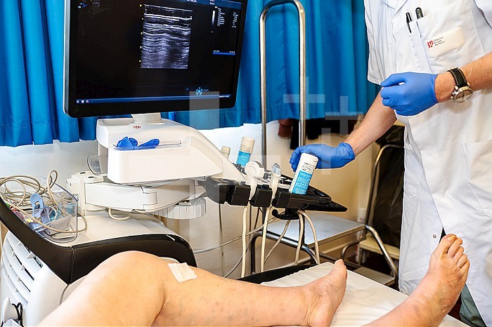 Treatment of varicose veins by foam echosclerotherapy, injection into a target vein of a sclerosing agent in foam form, under ultrasound guidance. The objective of this treatment is to damage the venous endothelium in order to destroy the venous wall through a phenomenon of fibrosis.