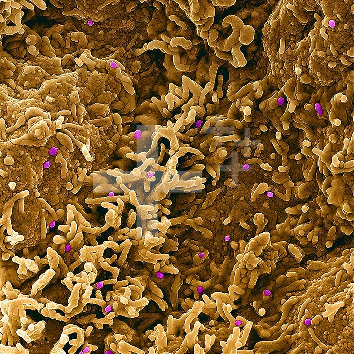 Colorized scanning electron micrograph of monkeypox virus (purple) on the surface of infected VERO E6 cells (tan).