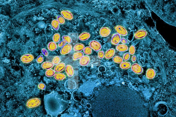 Variola virus (poxviruses are large viruses of 300/200/100 nm. They are pathogenic for humans such as smallpox and vaccinia viruses as well as animal viruses that infect humans such as viruses monkeypox, cowpox, milker´s nodule, pustular dermatitis in sheep Transmission electron microscopy.
