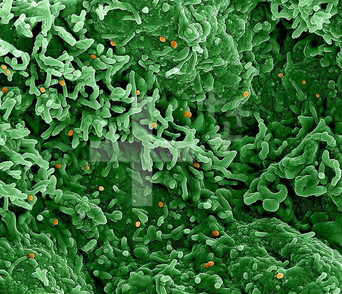 Colorized scanning electron micrograph of monkeypox virus (orange) on the surface of infected VERO E6 cells (green).