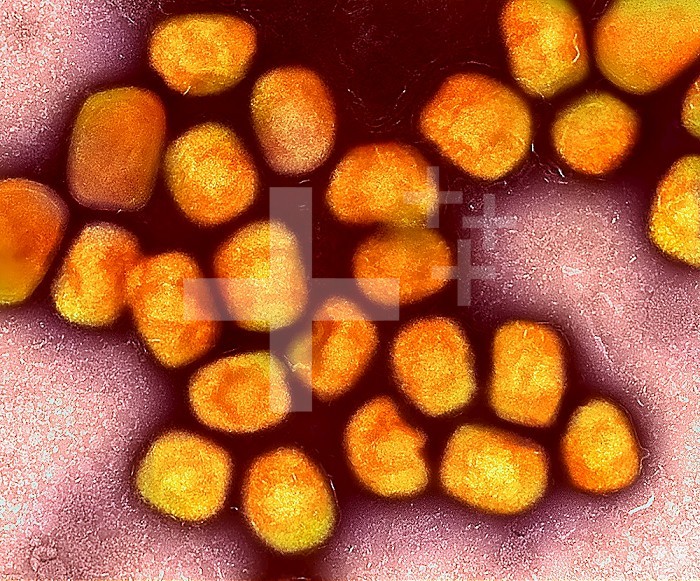 Colorized transmission electron micrograph of monkeypox virus particles (gold) cultivated and purified from cell culture.