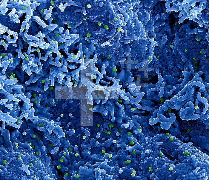 Colorized scanning electron micrograph of monkeypox virus (green) on the surface of infected VERO E6 cells (blue).
