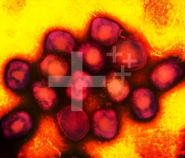 Colorized transmission electron micrograph of monkeypox virus particles (red) cultivated and purified from cell culture.