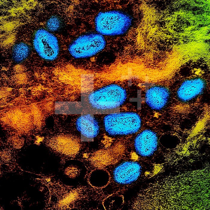 Colorized transmission electron micrograph of monkeypox virus particles (blue) found within an infected cell (brown and green), cultured in the laboratory.