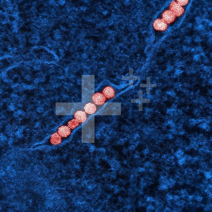 Transmission electron micrograph of West Nile virus particles (red) replicating within the cytoplasm of an infected VERO E6 cell (blue).