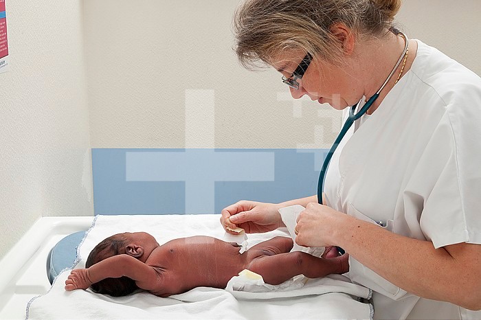 The pediatrician checks the appearance of the umbilical cord.