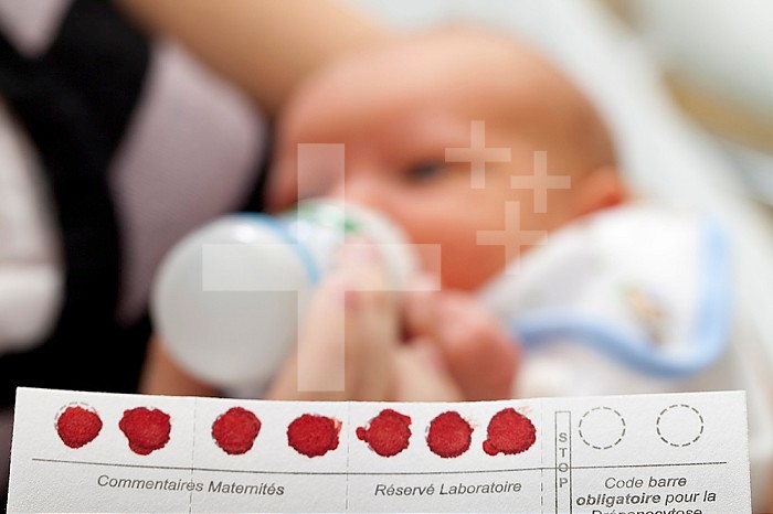 Hospital. Maternity. Drops of the newborn´s blood, taken from his heel, are placed on a name card for analysis on the detection of rare diseases such as cystic fibrosis.