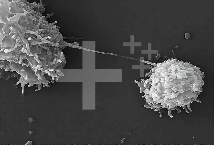 This scanning electron microscope (SEM) image revealed two Acanthamoeba polyphaga protozoa, as they interacted through their pseudopodia, projecting from the surfaces of these organisms. These pseudopodia allow the amoebae to move, to grasp objects in their environment and, in this case, to communicate with each other. CDC/Catherine Armbruster Margaret Williams 2009