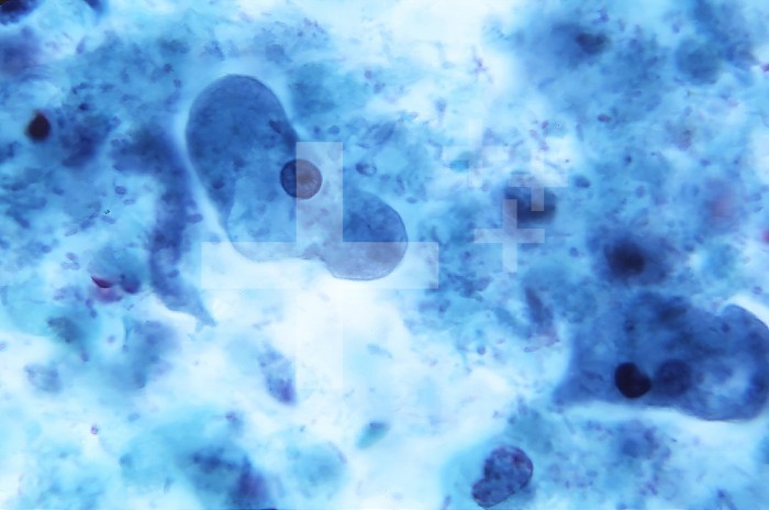 Under 1150X magnification, this photomicrograph of a trichrome-stained sample revealed the presence of parasitic Entamoeba coli trophozoites. CDC/ Dr. Green 1967