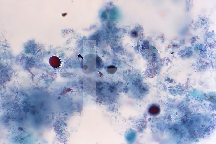 This photomicrograph of a trichrome-stained specimen, revealed a single Iodamoeba btschlii ( buetschlii ) parasitic cyst, within which youll note two achromatic glycogen granules (arrows), as well as a single, darkly stained intranuclear karyosome. CDC/ Dr. Mae Melvin 1977