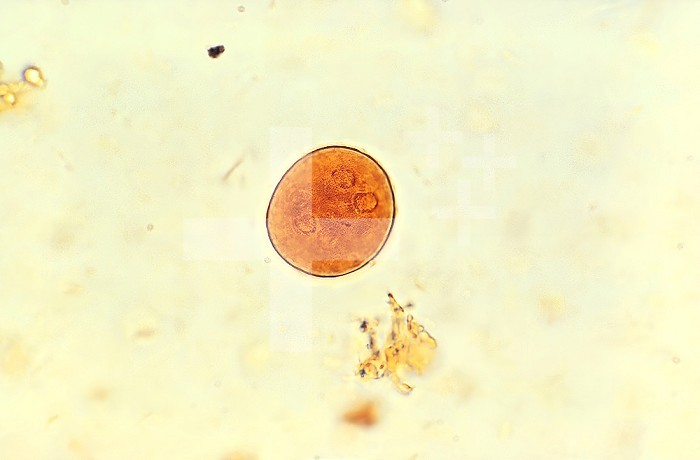 Processed using an iodine staining method, this photomicrograph revealed the morphological character of a single parasitic cyst of Entamoeba coli. Although difficult to see clearly, due to their location, there are usually eight nuclei in a mature cyst. CDC/Dr Mae Melvin 1977