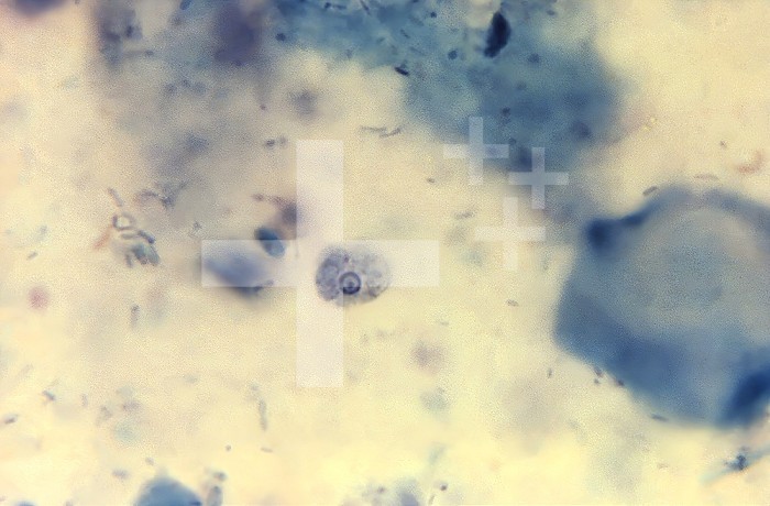 Under 1187.5X magnification, this photomicrograph of a trichrome-stained specimen revealed the presence of an Entamoeba hartmanni trophozoite. CDC/Dr. LLA Moore, Jr. 1969