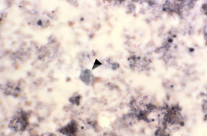 Using an iron-hematoxylin staining method, this photomicrograph reveals the presence of an unnucleated parasitic trophozoite, Dientamoeba fragilis, in this specimen (arrowhead). CDC/Dr Mae Melvin 1977