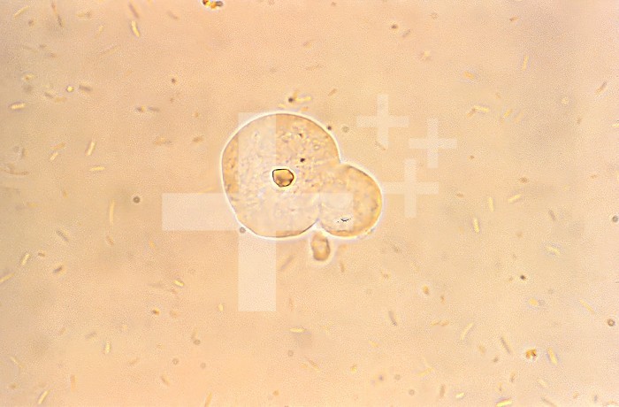 This photomicrograph was created from an unstained culture specimen and revealed the presence of a parasitic trophozoite, Entamoeba moshkovskii, which had ingested a rice particle. This trophozoite had extended a single pseudopodium. CDC/Dr Mae Melvin 1977