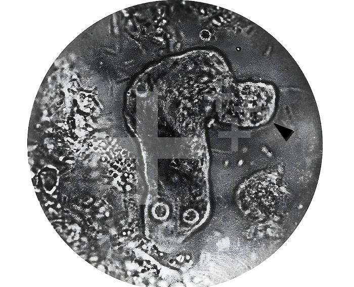 This photomicrograph of a living Entamoeba histolytica parasitic trophozoite reveals the method by which this organism moves. Note the pseudopodia which had been extruded by the amoeba laterally to the long axis of its body (arrowhead). CDC/Armed Forces Institute of Pathology, AFIP 1964