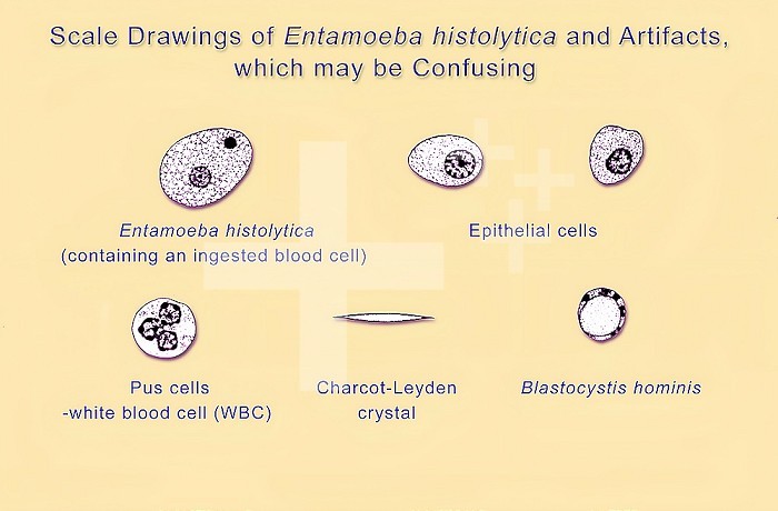Illustration of Entamoeba histolytica, epithelial cells, white blood cell, Charcot-Leyden crystal and blastocystis hominis.