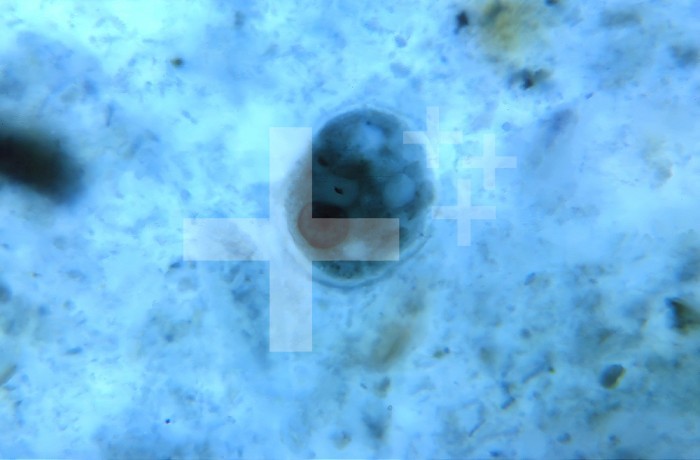 Under 900X magnification, this photomicrograph revealed the presence of a parasitic microorganism Entamoeba coli, at the trophozoite stage, in a specimen prepared using the Kohn staining method. CDC/Dr Healy 1964