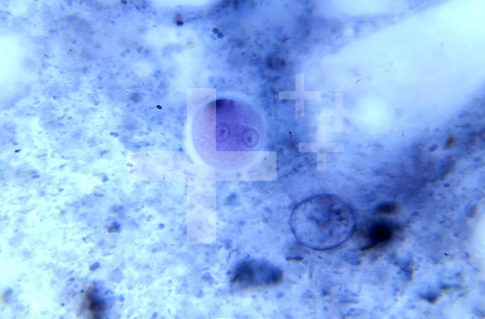 Under 900X magnification, this photomicrograph revealed the presence of an Entamoeba coli microorganism at the cyst stage, in a sample prepared using the Kohn stain method. In this focal plane you can see two distinct nuclei, each containing a single centrally located karyosome. CDC/Dr Healy 1964