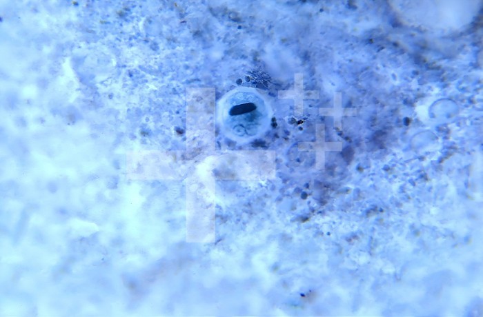 Under 900X magnification, this photomicrograph revealed the presence of an Entamoeba hartmanni microorganism at the cyst stage, in a specimen prepared using the Kohn staining method. In this focal plane you can see two distinct nuclei, each containing a single centrally located karyosome and a cigar-shaped, dark-colored chromatoid body. CDC/Dr Healy 1964