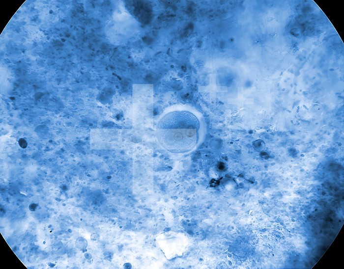 Under 900X magnification, this photomicrograph revealed the presence of an Entamoeba coli microorganism at the cyst stage, in a sample prepared using the Kohn stain method. In this focal plane you can see five nuclei, three of which contained a single centrally located karyosome. CDC/ Dr. Mae Melvin Dr. Healy 1964