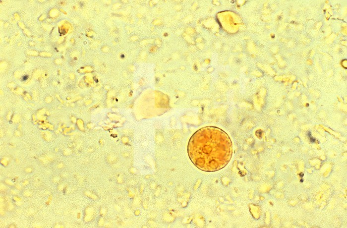 This iodine-stained photomicrograph revealed the presence of an Entamoeba histolytica amoebic parasitic cyst. This particular organism contained three clearly visible nuclei, or made a trinucleate cyst. CDC/Dr Mae Melvin 1977