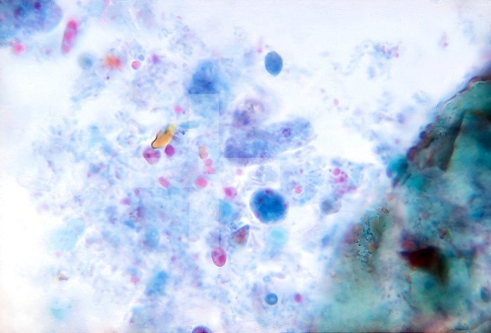 This photomicrograph revealed the presence of a trichrome-stained parasitic trophozoite Dientamoeba fragilis in this specimen. CDC 1970