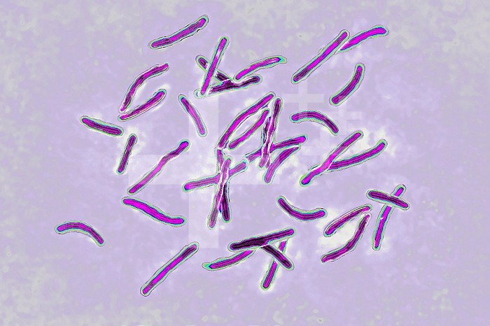 Bacillus Koch (Bk) or Mycobacterium tuberculosis, it is responsible for tuberculosis. Tuberculosis is making a comeback due to the appearance of multi-resistant bacterial strains. Pulmonary tuberculosis (phthisis) is the most widespread, but there are bone disorders (Pott´s disease, white tumor of the knee), renal, intestinal, genital, meningeal and skin disorders (tuberculomas). Image taken from an X 1000 optical microscopy.
