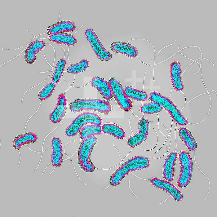 Cholera bacilli or cholera vibrio (Vibrio cholerae). Cholera is a contagious epidemic enteric poisoning infection. If left untreated, the classic major form is fatal in more than half of cases. Image taken from an X 1000 optical microscopy.