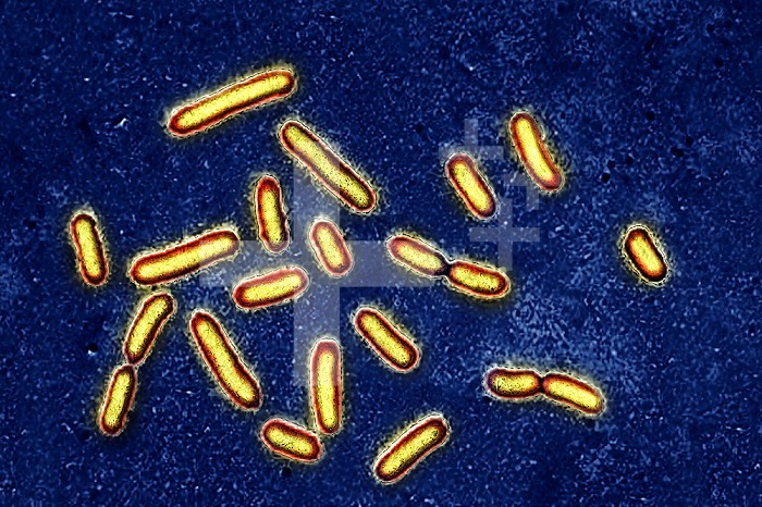 Pseudomonas aeruginosa or pyocyanin bacillus, pathogenic bacteria, very resistant and often responsible for nosocomial infections. It is one of the most difficult bacteria to eliminate clinically. The infections it causes concern: the eyes, burns, surgical wounds, urine, lungs, stomach, intestines, meninges, blood. Image taken from an X 1000 optical microscopy.