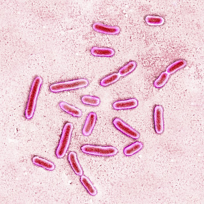 Pseudomonas aeruginosa or pyocyanin bacillus, pathogenic bacteria, very resistant and often responsible for nosocomial infections. It is one of the most difficult bacteria to eliminate clinically. The infections it causes concern: the eyes, burns, surgical wounds, urine, lungs, stomach, intestines, meninges, blood. Image taken from an X 1000 optical microscopy.