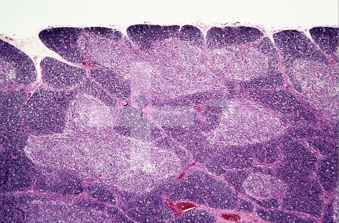Human thymus section showing the darker cortex and pale medulla of each lobule. H&E stain,  LM X10