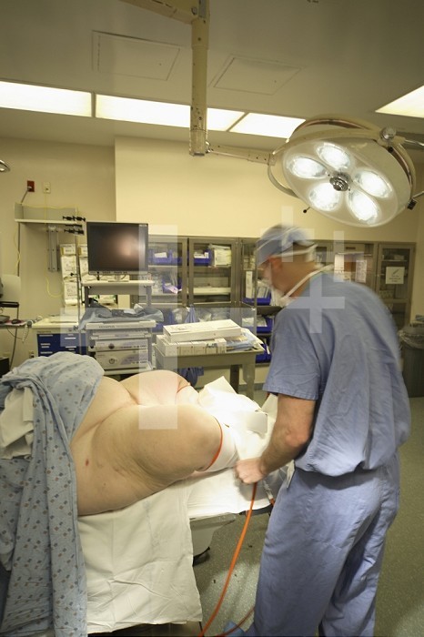 A morbidly obese patient in the operating room about to have a laparoscopic Roux-en Y gastric bypass. A sequential compression device (SCD) is being placed on the patient´s right leg to be used during the surgery to decrease the chance of deep venous thrombosis.