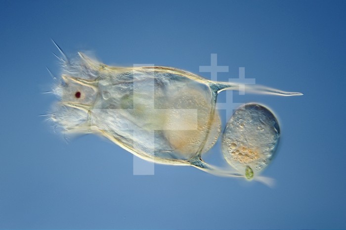 Keratella is a tail-less Rotifer with a spiked lorica or shell. DIC, LM X250.