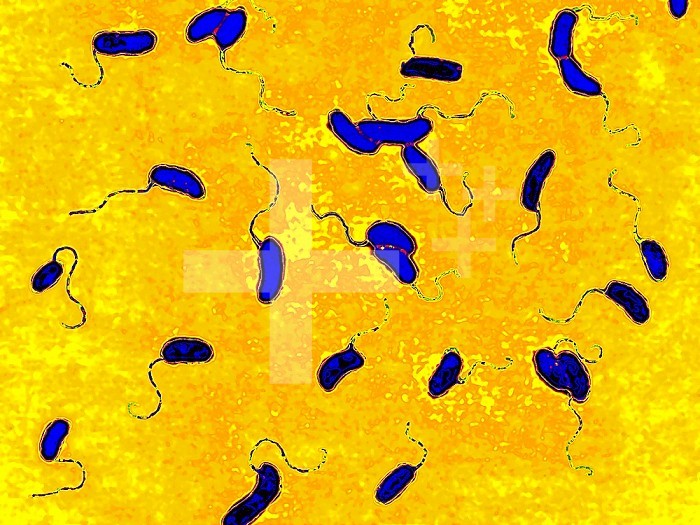 Cholera bacillus or vibrion (vibrio cholerae). Cholera is a contagious and epidemic toxic infection of the intestine. It is characterised by severe and abundant diarrhea. If not treated, the main classic strain of the disease is fatal in more than half the cases. Optical microscopy x 1850.