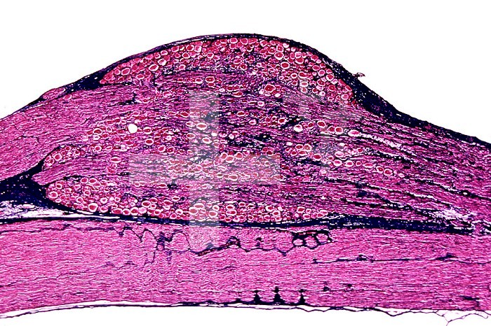 Spinal ganglion section showing nerve roots. LM X6.