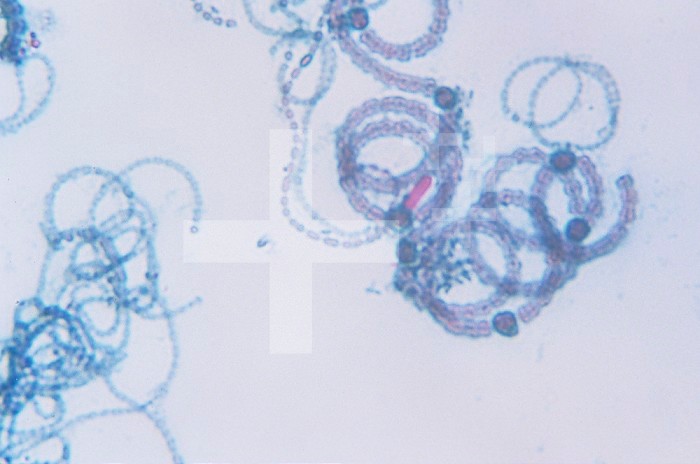 Anabaena Cyanobacteria with heterocysts. LM X200.