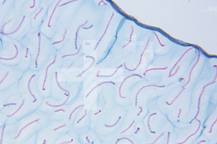 Section of a Nostoc Cyanobacteria colony. LM X65.