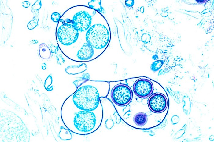 Water Mold ,Saprolegnia, showing a sperm tube. LM X160