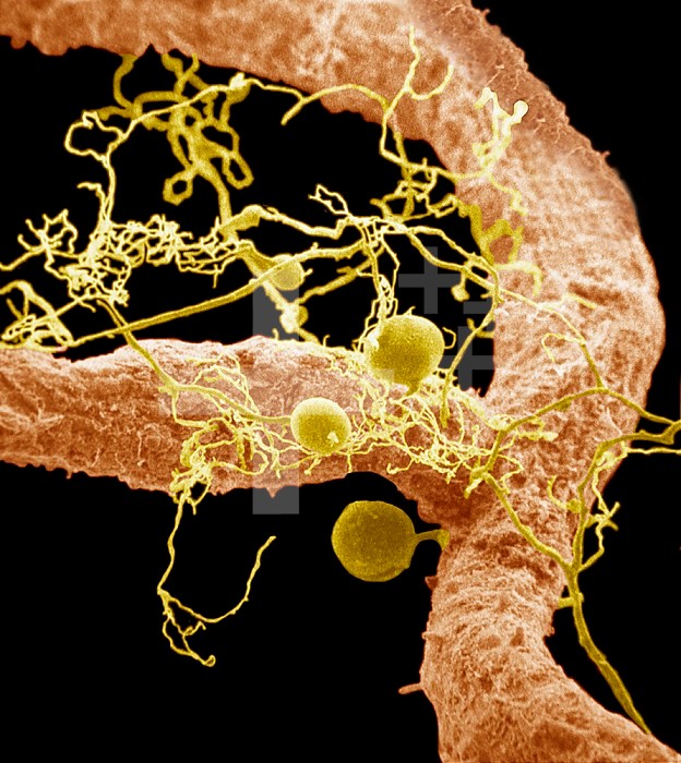 Mycorrhizae on a Soybean root. Mycorrhizae form a mutualistic symbiotic relationship with the roots of the plant. This association provides the fungus with a renewable source of food, and allows the plant to make use of the large fungal mycelium surface area to absorb nutrients from the soil. SEM X150.