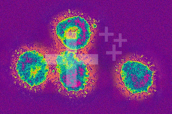 Corona Virus, showing its halo or crown-like (corona) appearance. The coronavirus is the pathogen that causes SARS or sudden acute respiratory syndrome. TEM X300,000