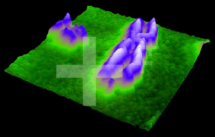 Fragile X chromosome made visible by Atomic Force Microscopy (AFM).