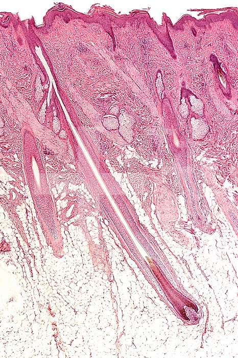 Skin section through a hair shaft and follicle. LM X8.