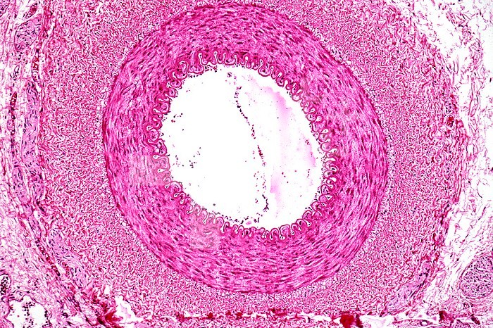Normal human infant artery cross-section, H&E stain. LM X26.
