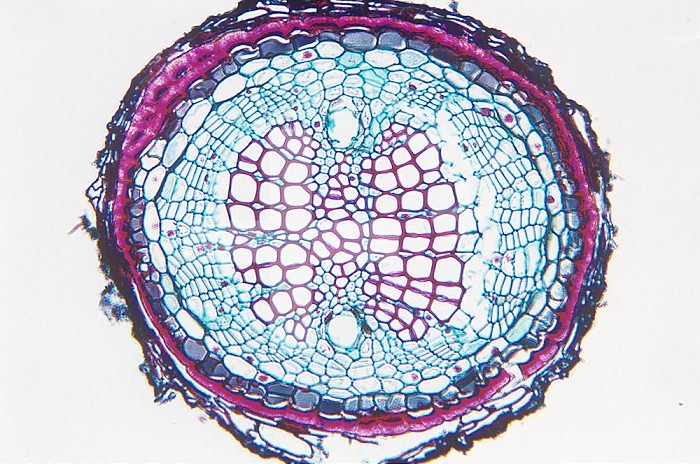 Cross section of a one-year Pine (Pinus) root. LM