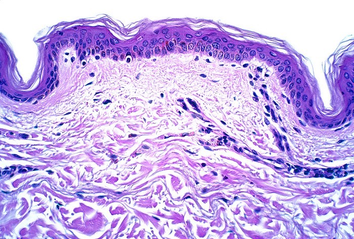 Thin skin of the anterior abdominal wall, H&E stain. LM X80.