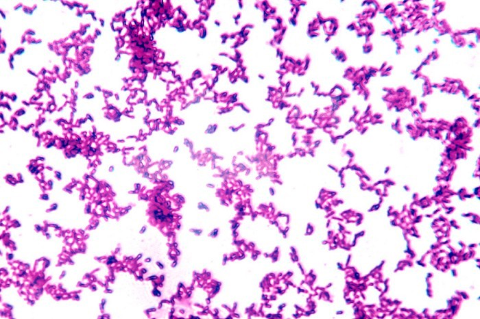 Shigella dysenteriae Bacteria are pathogenic bacilli that cause dysentery. LM X600